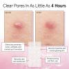 imagegrace ampamp stella Award Winning Acne Device  Pimple Patches for Face  FSA HSA Hydrocolloid Acne Patches  Absorbs Zits Reduces Redness  Cute Patches DermatologistTested Vegan Multishape 36 CountClear Confidence 72Pack