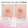 imagegrace ampamp stella Award Winning Acne Device  Pimple Patches for Face  FSA HSA Hydrocolloid Acne Patches  Absorbs Zits Reduces Redness  Cute Patches DermatologistTested Vegan Multishape 36 CountClear Confidence 36Pack
