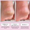 imagegrace ampamp stella AwardWinning Foot Peeling Mask  Foot Peel Masks with Aloe Vera Moisturizing Foot Masks That Remove Dead Skin Exfoliating Foot Mask for Dry Cracked Feet 4 Pairs UnscentedUnscented with Aloe Vera  2 Pairs