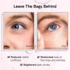 imagegrace ampamp stella Retinol ampamp Caffeine Under Eye Serum Anti Aging  Travel Essentials  Hydrating Cream with Niacinamide Peptides  Reduce Wrinkles Crows Feet Puffiness  Vegan Skincare 05 floz15mlEye Roller 15ml  05 Fl oz
