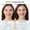 imagegrace ampamp stella Award Winning Hyaluronic Acid Face Serum 50ml17 fl oz Removes Fine Lines ampamp Wrinkles Hydrating Hyaluronic Acid Serum for Face Acido Hialuronico for Women  Vegan Skincare 2Pack50ml Pump Pack of 2