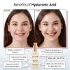 imagegrace ampamp stella Award Winning Hyaluronic Acid Face Serum 50ml17 fl oz Removes Fine Lines ampamp Wrinkles Hydrating Hyaluronic Acid Serum for Face Acido Hialuronico for Women  Vegan Skincare 2Pack50ml Pump