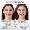 imagegrace ampamp stella Award Winning Hyaluronic Acid Face Serum 50ml17 fl oz Removes Fine Lines ampamp Wrinkles Hydrating Hyaluronic Acid Serum for Face Acido Hialuronico for Women  Vegan Skincare 2Pack10ml Dropper Travel Size